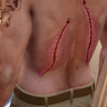 Missing organs skin replacer for Trevor 1.0